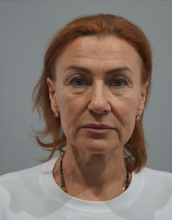 До